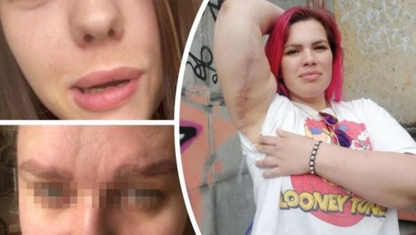 Жертвы новосибирских косметологов рассказали свои истории и показали фото Жертвы новосибирских косметологов рассказали свои истории и показали фото